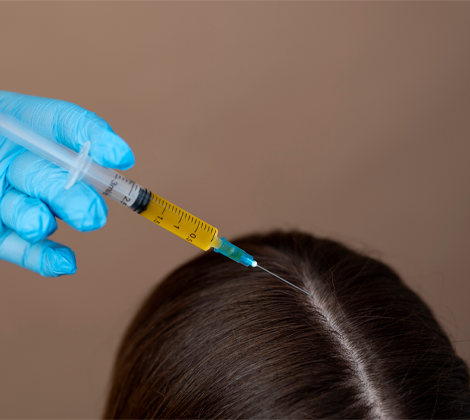 PRP Therapy